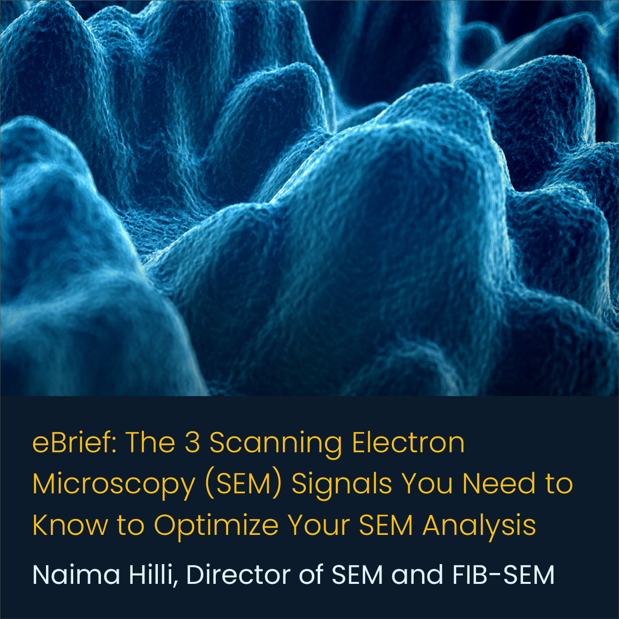 3 Scanning Electron Microscopy (SEM) Signals You Need to Know to Optimize Your SEM Analysis