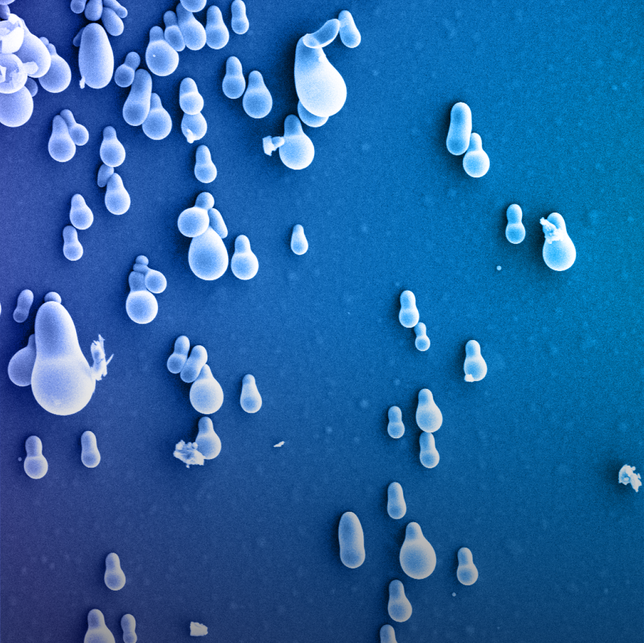 SEM Detectors: Selecting the Information You Want During SEM Analysis