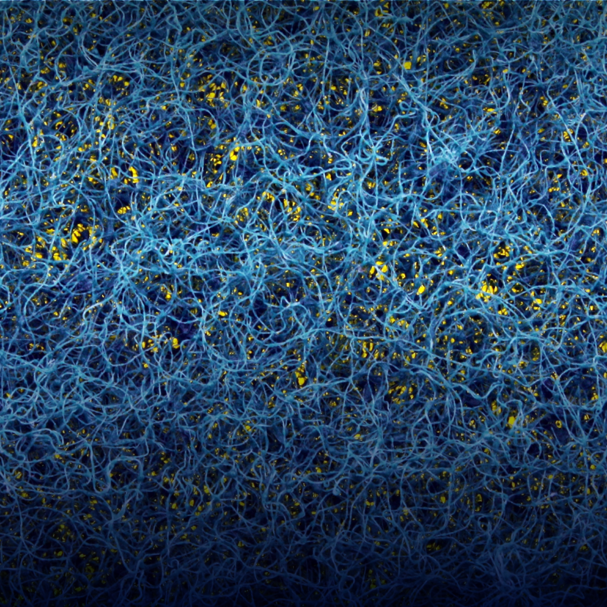 Porous Materials Characterization with Porometry, Porosimetry, and Pycnometry