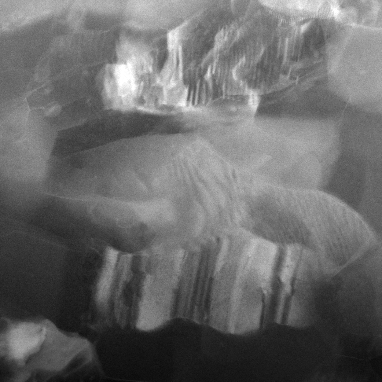 The Age of (Scanning) Transmission Electron Microscopy is Here