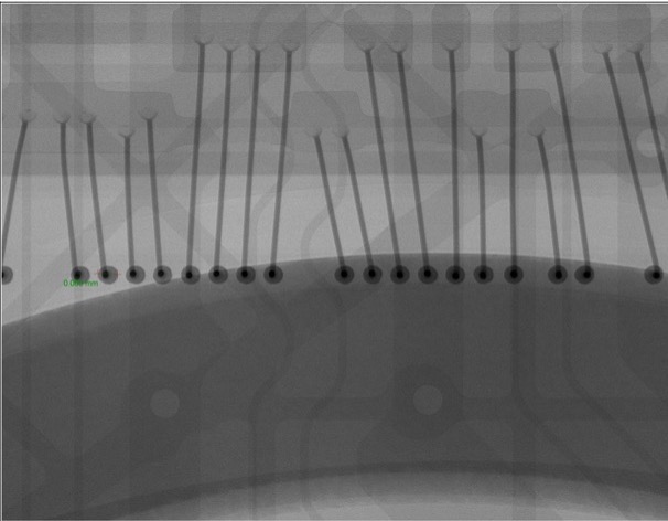 2D X-ray Radiograph of Cell Phone: View 3